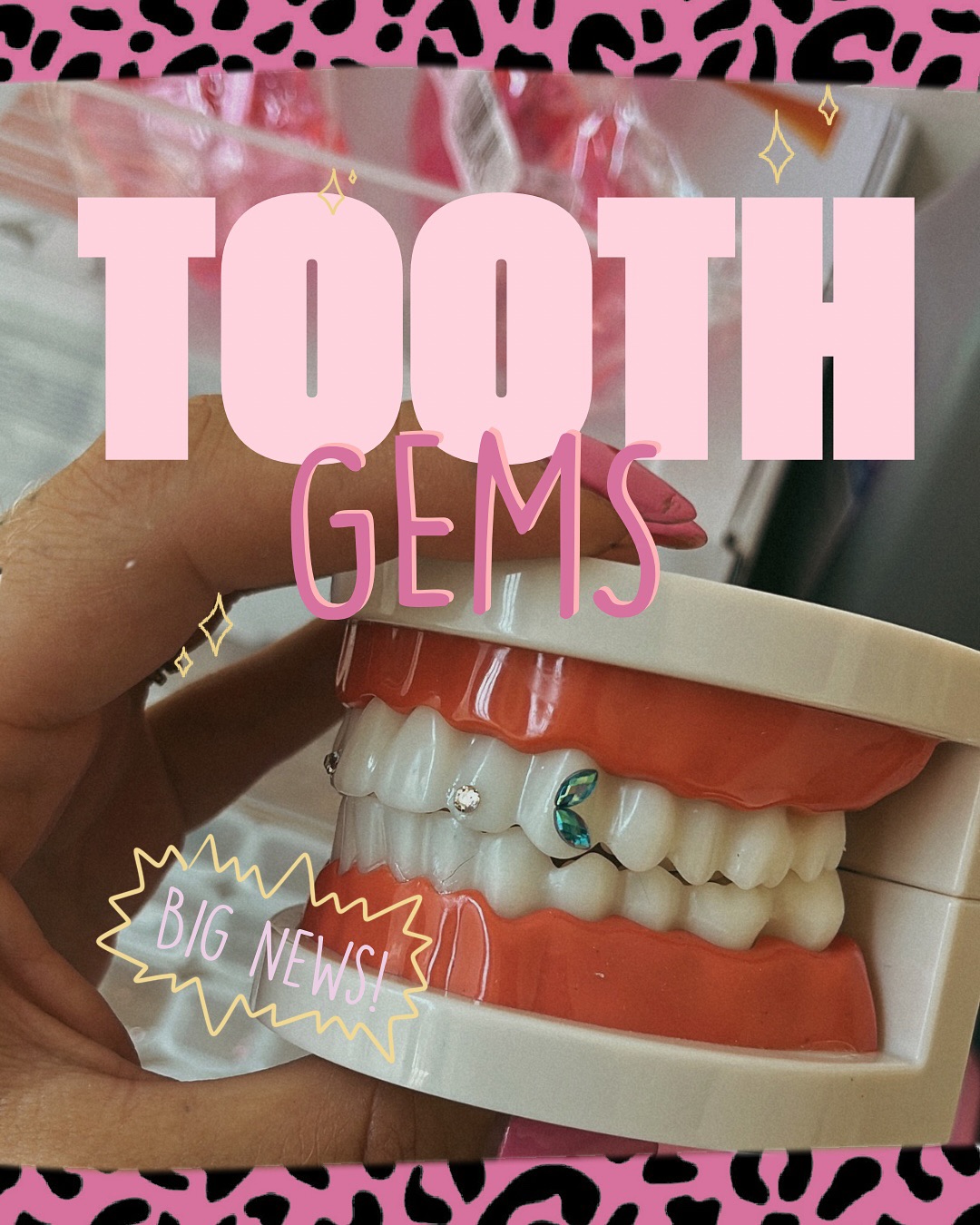 Tooth Gems